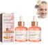 2Pcs Advanced Deep Anti-Wrinkle Serum,30Ml Pore Shrink Face Serum Hyaluronic Acid Moisturizing Nourish Essence,Advanced Deep Anti-Wrinkle Serum for Face Care