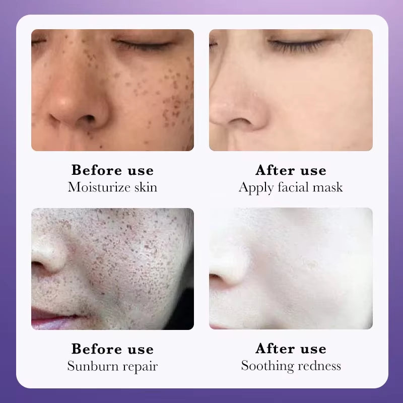 10Pcs Freckle Removing Skin Whitening Cream Skincare Moisturizing Anti-Aging Facial Creams Whitening Face Cream Beauty Skin Care