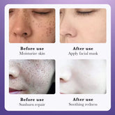 10Pcs Freckle Removing Skin Whitening Cream Skincare Moisturizing Anti-Aging Facial Creams Whitening Face Cream Beauty Skin Care